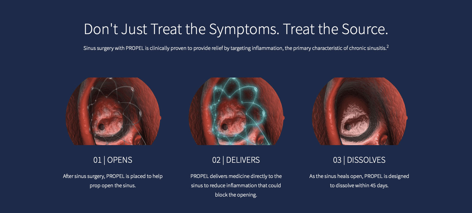 ENT New York | Sleep Apnea, Neck Masses and Hearing Evaluation